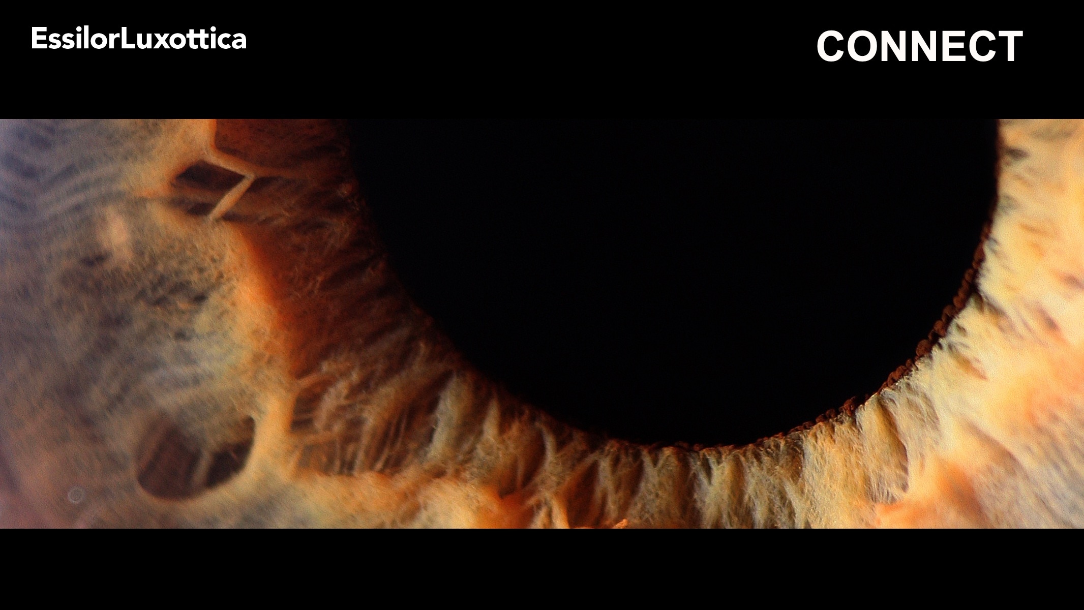 https://media.essilorluxotticaeyecare.com/cms/caas/v1/media/3046/data/168f981f5e5f15b1541450825b583868/videothumbnail.jpg
